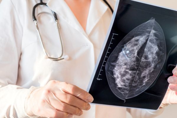 Moderní zobrazovací metody v prevenci karcinomu prsu