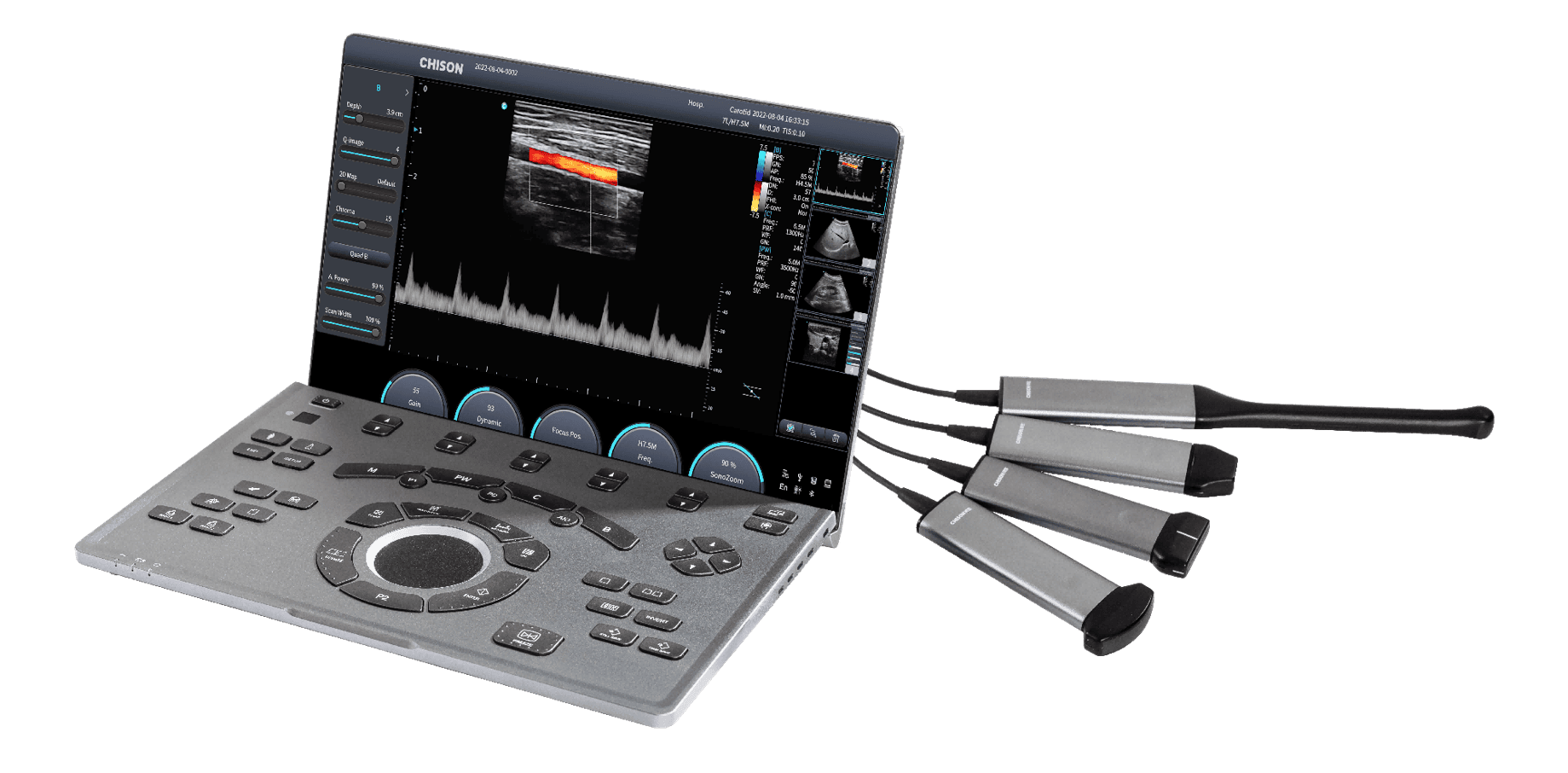 SonoAir